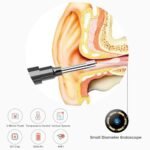 1080P Ear Wax Removal Otoscopes 360
