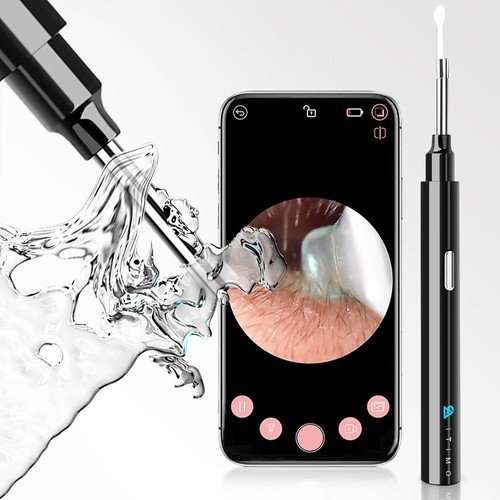 1080P Ear Wax Removal Otoscopes 360