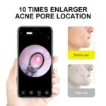 SUNUO X8 Smart Visual Ear Cleaner